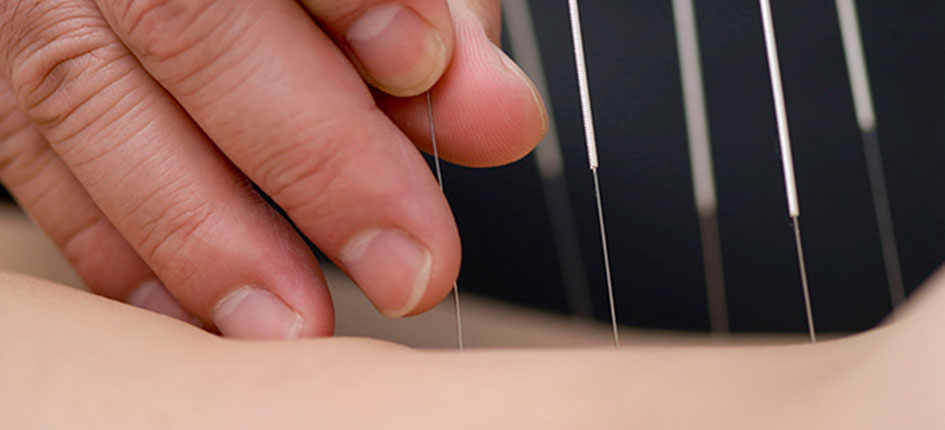 Header acupuntura fisioespai